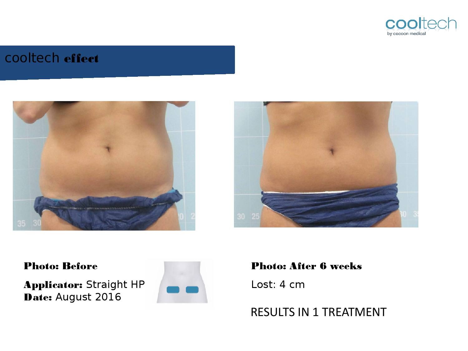 Presentation Cooltech ENG Wigmore Days Novaaaa1-page-004